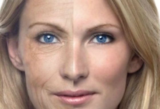 Comment maintenir la lutte contre le vieillissement de la peau avec des remèdes maison?