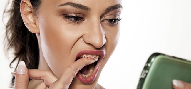 Comment prévenir les lèvres de pénétrer sur votre dents