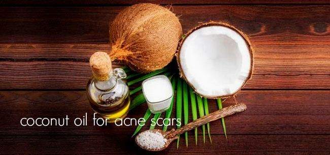 Comment faire pour supprimer les cicatrices d'acné avec l'huile de coco