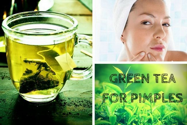 Comment traiter l'acné rapidement avec du thé vert