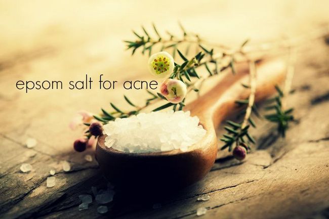 le sel d'Epsom pour l'acné