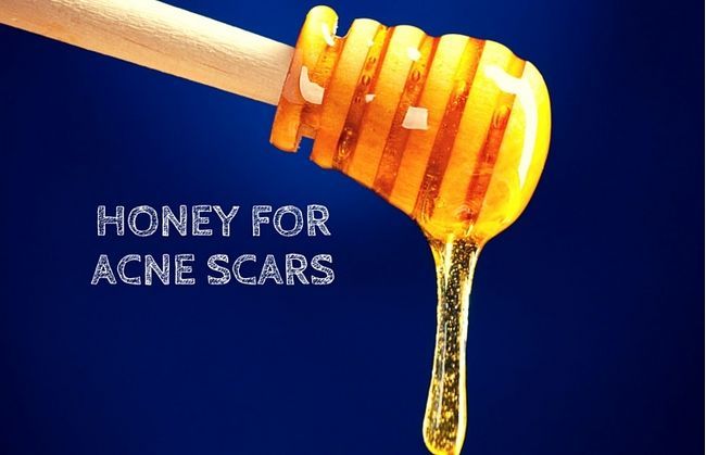 Comment utiliser le miel pour les cicatrices d'acné (11 façons)