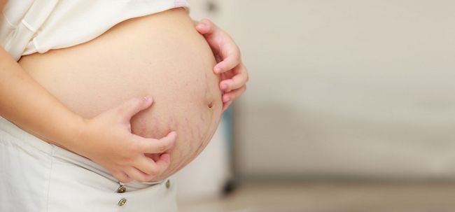 Démangeaisons pendant la grossesse - ses causes, les traitements et les remèdes à la maison