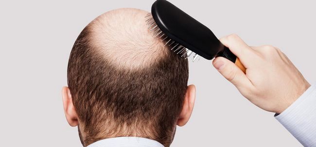 Mésothérapie Pour la croissance des cheveux - ça marche?