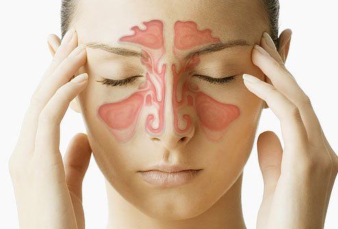 Sinus remèdes maison, des conseils et des traitements