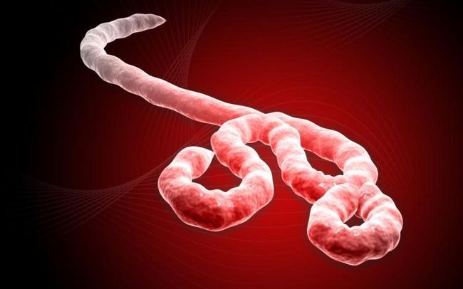 Quel est Ebola Quels sont ses premiers signes Suggestion sur le mécanisme de prévention et de traitement