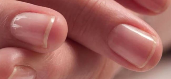 Quel est polissage des ongles et comment le faire à la maison?