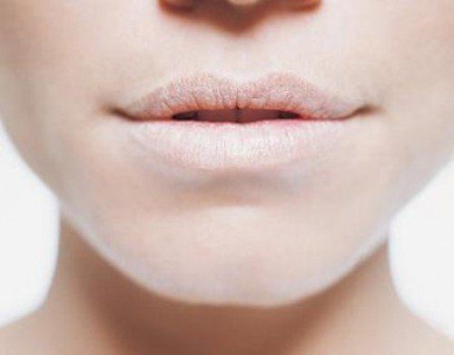 Hiver conseils de soins des lèvres pour traiter les lèvres sèches et gercées
