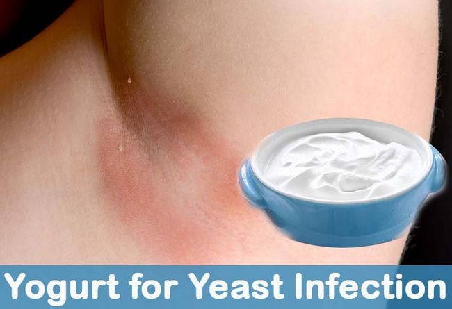 Yogourt pour Yeast Infection