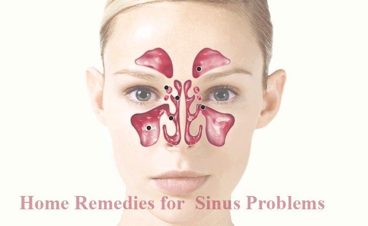 20 Accueil simples remèdes pour réduire les problèmes de sinus