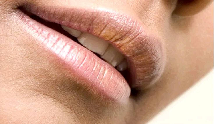30 Accueil recours pour Black Lips