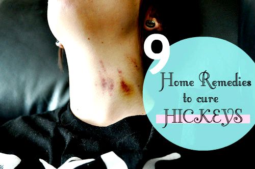 9 efficaces remèdes maison pour guérir Hickeys