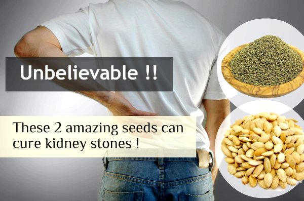 Tu as gagné't believe how these 2 amazing seeds can remove kidney stones effortlessly!