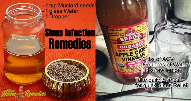 14 simples remèdes maison pour l'infection des sinus