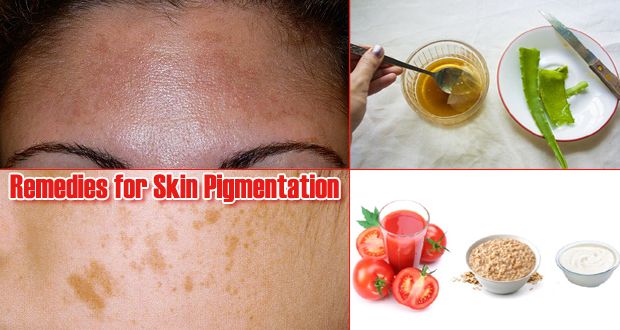 15 Accueil recours pour pigmentation de la peau