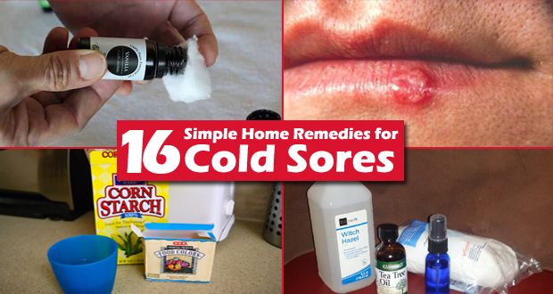 16 simples remèdes maison pour les boutons de fièvre