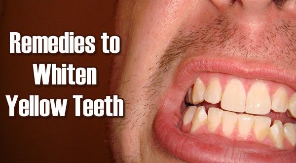 5 remèdes surprenants pour blanchir les dents jaunes