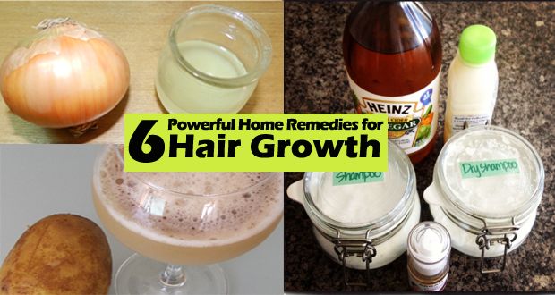 Top 6 des remèdes pour la croissance des cheveux