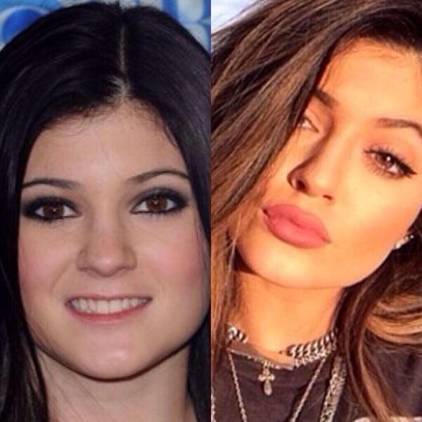 kylie-lèvres-hypehair