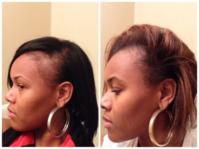Partum post cheveux hypehair