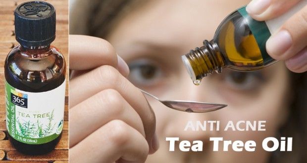 Tea Tree Oil pour l'acné