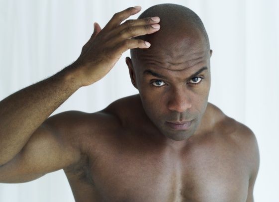 homme noir calvitie